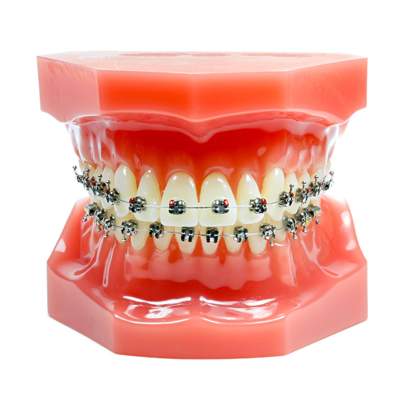 Lot De 10 Attaches Orthodontiques En Acier Inox Sans Crochet - Pour Appareils Dentaires Lingual - Neuf Sous Blister